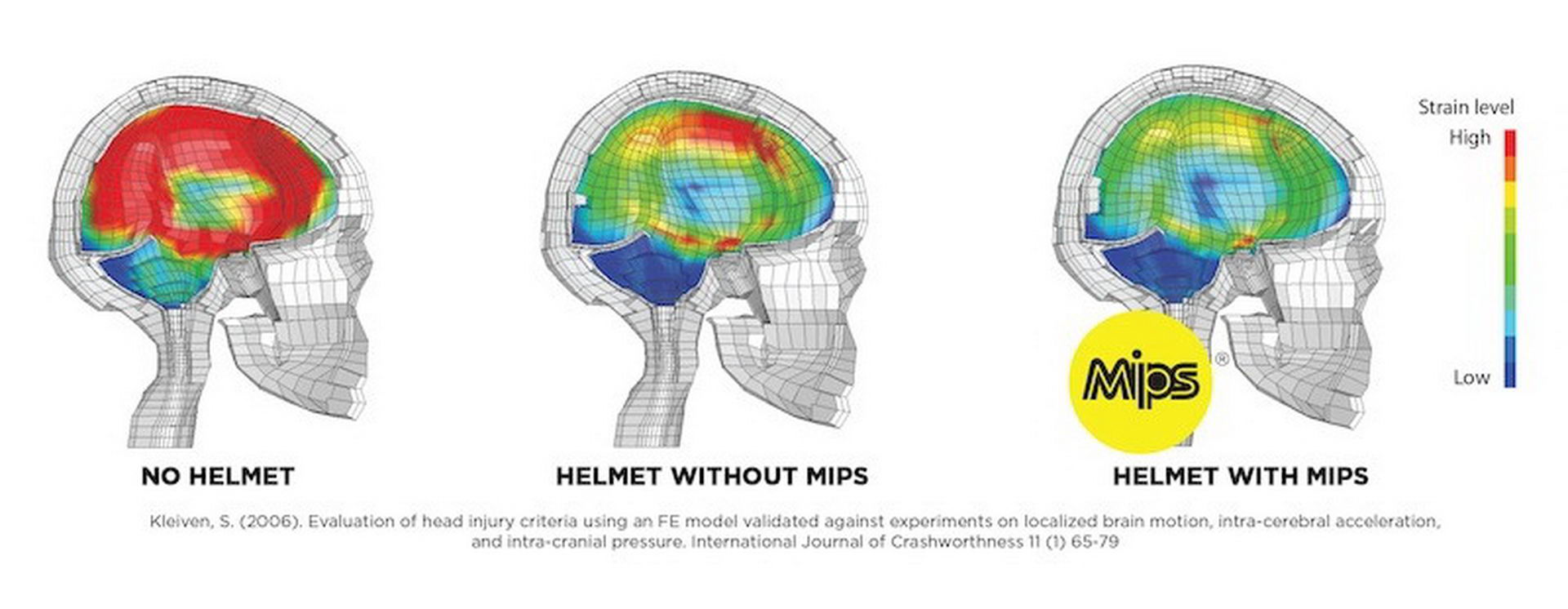 MIPS